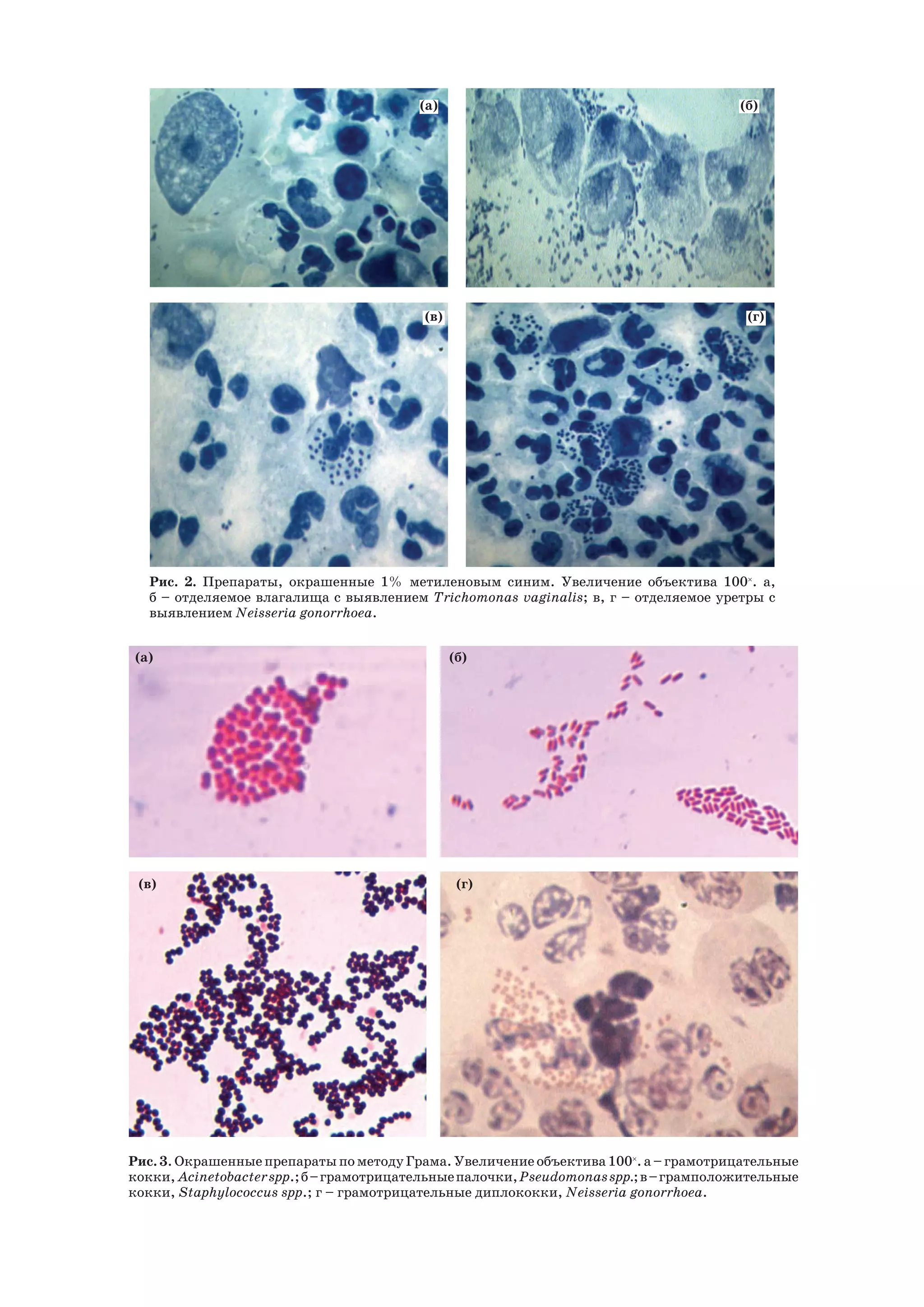 (а) (б)
(в) (г)
Рис. 2. Препараты, окрашенные 1% метиленовым синим. Увеличение объектива 100×
. а,
б – отделяемое влагалища с выявлением Trichomonas vaginalis; в, г – отделяемое уретры с
выявлением Neisseria gonorrhoea.
Рис. 3. Окрашенные препараты по методу Грама. Увеличение объектива 100×
. а – грамотрицательные
кокки, Acinetobacterspр.;б–грамотрицательныепалочки,Pseudomonasspр.;в–грамположительные
кокки, Staphylococcus spр.; г – грамотрицательные диплококки, Neisseria gonorrhoea.
(а) (б)
(в) (г)
 