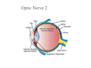 Optic Nerve 2
 