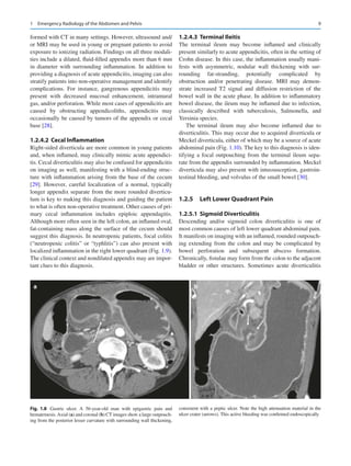 Diseases of the Abdomen and Pelvis 2023-2026: Diagnostic Imaging Juerg ...