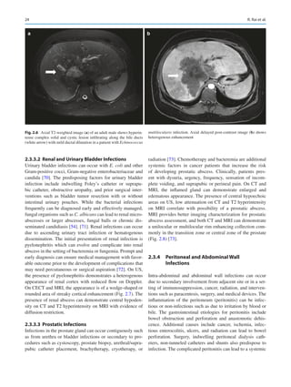 Diseases of the Abdomen and Pelvis 2023-2026: Diagnostic Imaging Juerg ...