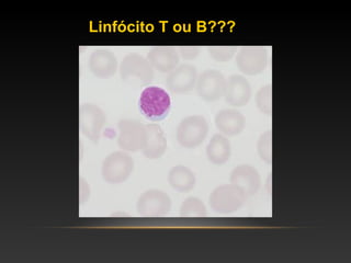 Linfócito T ou B???
 