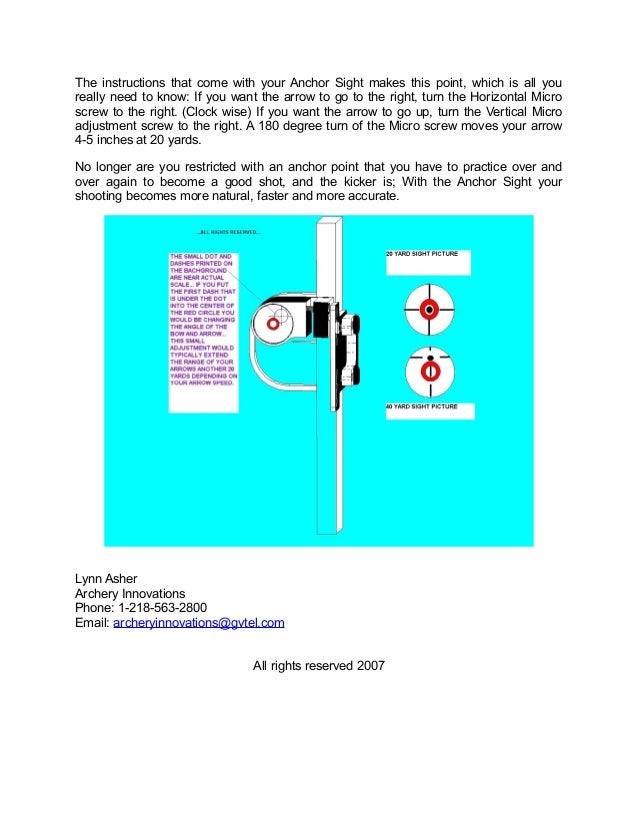 What is an anchor Sight