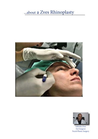 ...about a Zves Rhinoplasty
Sokratis Zves
Ent Surgeon
Facial Plastic Surgery
 