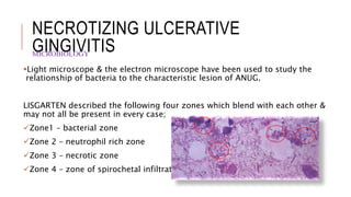 Acute Gingival Infections | PPTX
