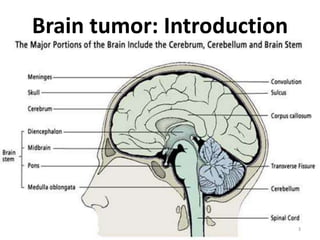 Brain tumor: Introduction
3
 