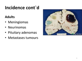 Incidence cont`d
Adults
• Meningiomas
• Neurinomas
• Pituitary adenomas
• Metastases tumours
9
 