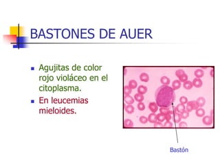 BASTONES DE AUER

   Agujitas de color
    rojo violáceo en el
    citoplasma.
   En leucemias
    mieloides.



                          Bastón
 