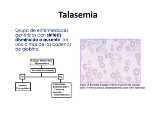 Anemia hemolítica del Recién nacido
• Isoinmune. Anticuerpos de la madre
• Sistema ABO
• Sistema Rh
• Otros sistemas
• Tes...