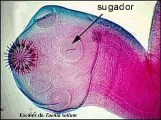 Escólex da Taenia solium
 