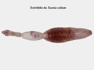 Estróbilo da Taenia solium
 