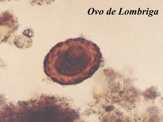 Ovo de Lombriga
 