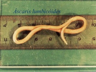 Áscaris lumbicóides
 