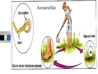 Amarelão
 