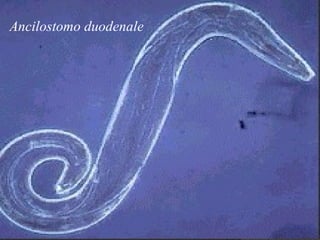 Ancilostomo duodenale
 