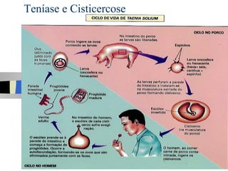 Teníase e Cisticercose
 