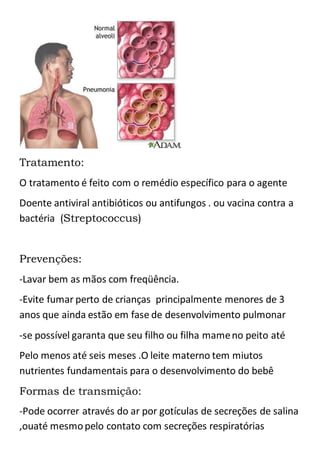Tratamento:
O tratamento é feito com o remédio específico para o agente
Doente antiviral antibióticos ou antifungos . ou vacina contra a
bactéria (Streptococcus)
Prevenções:
-Lavar bem as mãos com freqüência.
-Evite fumar perto de crianças principalmente menores de 3
anos que ainda estão em fase de desenvolvimento pulmonar
-se possível garanta que seu filho ou filha mameno peito até
Pelo menos até seis meses .O leite materno tem miutos
nutrientes fundamentais para o desenvolvimento do bebê
Formas de transmição:
-Pode ocorrer através do ar por gotículas de secreções de salina
,ouaté mesmopelo contato com secreções respiratórias
 
