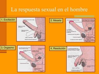 La respuesta sexual en el hombre
1. Excitación 2. Meseta
3. Orgasmo 4. Resolución
 