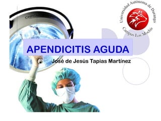 APENDICITIS AGUDA
José de Jesús Tapias Martínez
 