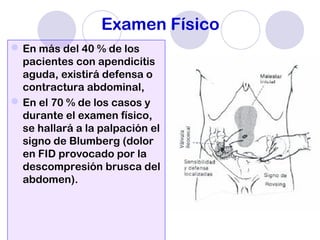 Examen Físico
En más del 40 % de los
pacientes con apendicitis
aguda, existirá defensa o
contractura abdominal,
En el 70 % de los casos y
durante el examen físico,
se hallará a la palpación el
signo de Blumberg (dolor
en FID provocado por la
descompresión brusca del
abdomen).
 
