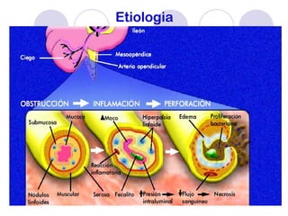 Etiologia
 