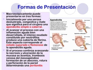 Formas de Presentación
 Macroscópicamente puede
presentarse en tres formas:
 Inicialmente por una serosa
deslustrada, congestiva y mate
que significa para el cirujano una
apendicitis simple o catarral.
 Al avanzar el proceso con una
inflamación aguda bien
desarrollada, el intenso exudado
constituido por neutrófilos
produce una cubierta de fibrina.
Este aspecto corresponde al
estado supurado o flemonoso de
la apendicitis aguda.
 Si el proceso continúa avanzando
la necrosis y ulceración de la
mucosa se acentúa, trombosis
venosa del mesoapéndice
formación de un absceso, rotura
y perforación de la pared
determinando una peritonitis
 
