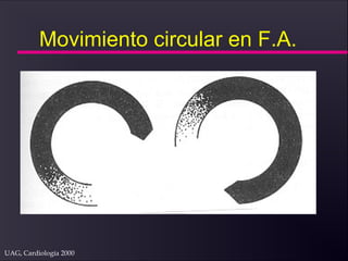 UAG, Cardiología 2000
Movimiento circular en F.A.
 