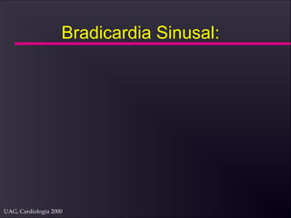 UAG, Cardiología 2000
Bradicardia Sinusal:
 