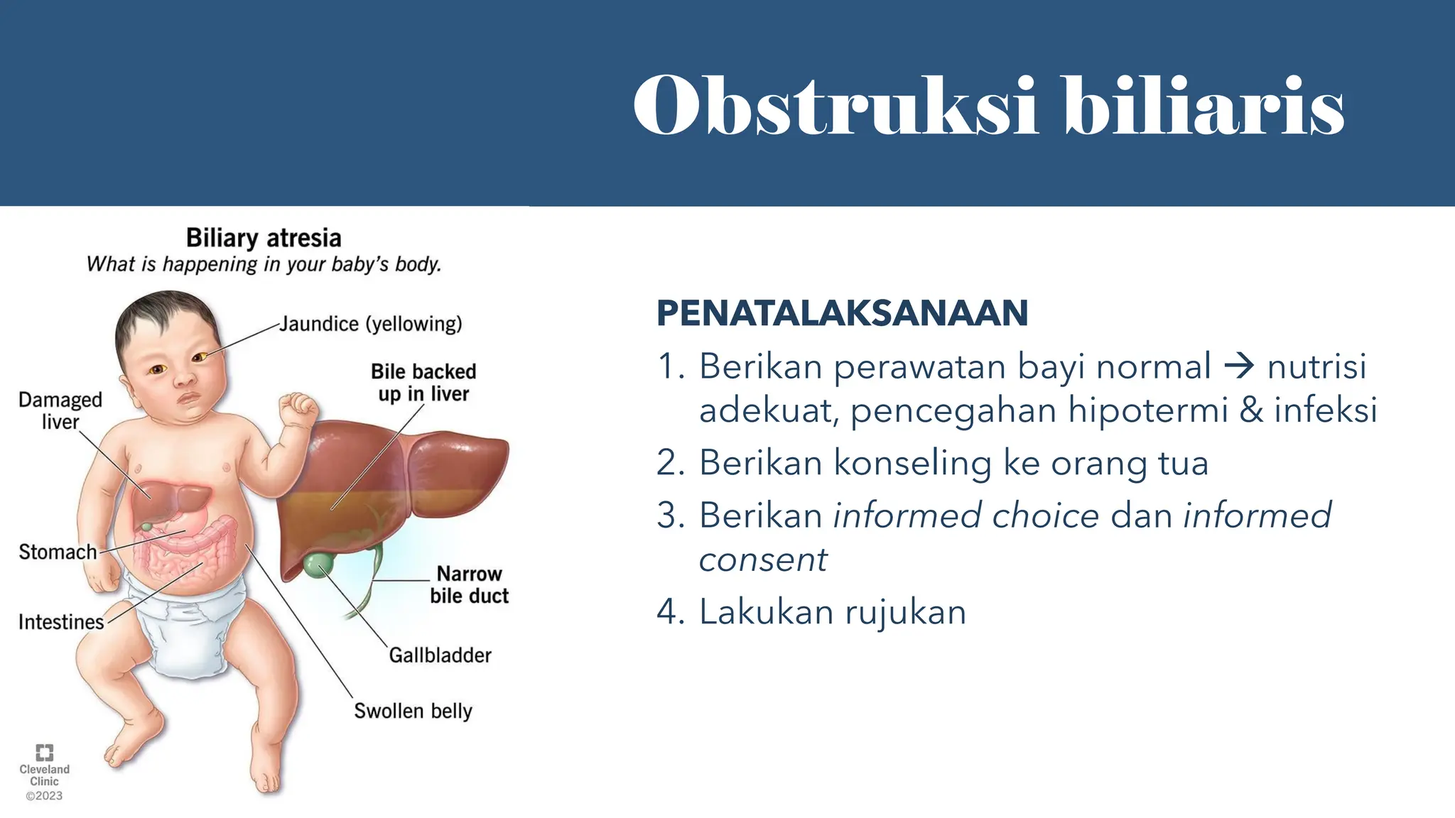 7 Asuhan Kebidanan dengan kelainan bawaan pada Bayi.pdf