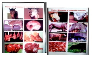 7 aspiration pneumonia 