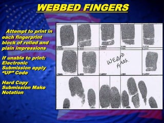 Corresponding Fingerprint “Incorrect” SCARSPermanent tissue damage to the finger or thumb.