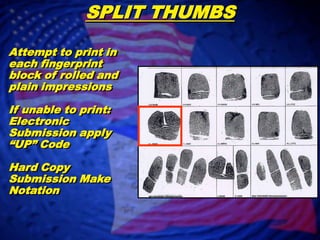 Corresponding    Fingerprint “Correct” SCARSRoll fingerprints as Normalno notation required
