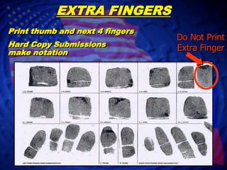 WEBBED FINGERSAttempt to print in each fingerprint block of rolled and plain impressionsIf unable to print:Electronic Submission apply “UP” CodeHard Copy Submission Make Notation