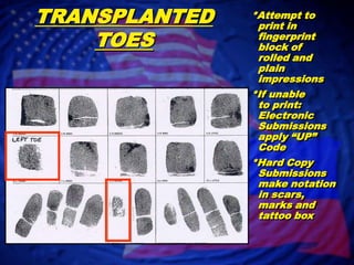 SPLIT THUMBSAttempt to print in    each fingerprint block of rolled and plain impressionsIf unable to print:Electronic Submission apply “UP” CodeHard Copy Submission Make Notation