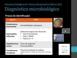 Amostras biológicas do Sistema Respiratório Inferior (III)

Diagnóstico microbiológico
Provas de identificação
     Agente                                 Teste

 Streptococcus
                  Suscetibilidade à optoquina
 pneumoniae

                  Gelose de sangue com discos de:
 Haemophilus      • Fator X (hematina)
 influenzae       • Fator V (NAD)
                  • Fatores X + V

 Staphylococcus   Prova da coagulase
 aureus           Prova da DNAse

 Pseudomonas      Prova de produção de oxidase                                   37
                  (oxidase positivos: P. aeruginosa, Neisseria spp., Moraxella
 aeruginosa       spp)
 