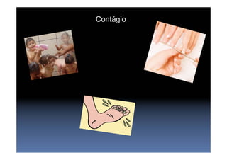 Contágio
 