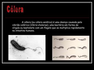 A cólera (ou cólera asiática) é uma doença causada pelo
vibrião colérico (Vibrio cholerae), uma bactéria em forma de
vírgula ou bastonete com um flagelo que se multiplica rapidamente
no intestino humano.
 