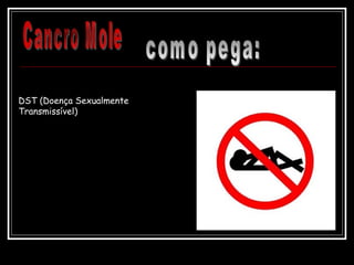 DST (Doença Sexualmente
Transmissível)
 