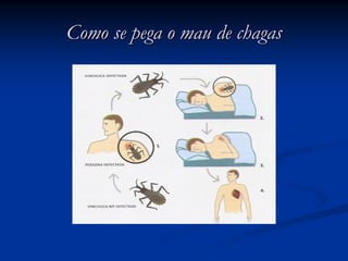 Como se pega o mau de chagasComo se pega o mau de chagas
 