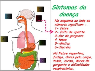 Sintomas da
doença
No esquema ao lado os
números significam :
1- febre
2- falta de apetite
3-dor de garganta
4-tosse
5-vômitos
6-diarréia
Há Febre repentina,
fadiga, dores pelo corpo,
tosse, coriza, dores de
garganta e dificuldades
respiratórias.
 