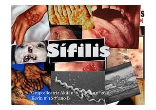 Grupo:Beatriz Akiti nº6, Natália nº26 e
Kevin nº16 7ºano B
 