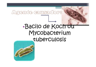 •Bacilo de Koch ou
Mycobacterium
tuberculosis
 