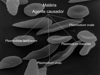 Agente causador
Plasmodium falciparum
Plasmodium vivax
Plasmodium malariae
Plasmodium ovale
Malária
 