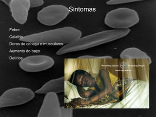 Sintomas
Febre
Calafrio
Dores de cabeça e musculares
Aumento do baço
Delírios
 