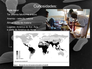 Curiosidades:
Pode matar
Ter anemia falciforme é lucro
Anemia – seleção natural
África –surto de malária
Lugares: América do Sul, Ásia
e parte da América do Norte
 