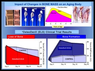 Loss of Bone
Substance
Bone Formation
*OsteoDenX (ELS) Clinical Trial Results
Years of Age
Impact of Changes in BONE MASS on an Aging Body
Men
Women
Peak Bone Mass
OsteoDenX (ELS)
OsteoDenX (ELS)
 