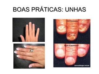 BOAS PRÁTICAS: UNHAS
 