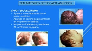 TRAUMATISMOS OSTEOCARTILAGINOSOS
CAPUT SUCCEDANEUM
- Aparece inmediatamente tras el
parto – eutócico.
- Aparece en la zona de presentación
en los partos en cefálica.
- No precisa tratamiento y remite en
24 a 72 horas postparto.
 