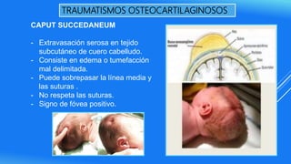 TRAUMATISMOS OSTEOCARTILAGINOSOS
CAPUT SUCCEDANEUM
- Extravasación serosa en tejido
subcutáneo de cuero cabelludo.
- Consiste en edema o tumefacción
mal delimitada.
- Puede sobrepasar la línea media y
las suturas .
- No respeta las suturas.
- Signo de fóvea positivo.
 