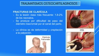 TRAUMATISMOS OSTEOCARTILAGINOSOS
FRACTURAS DE CLAVÍCULA
- Es la lesión ósea más frecuente: 1.8-2%
de los neonatos.
- Se produce por dificultad de paso del
diámetro biacromial por el canal del parto.
- La clínica es de deformidad y crepitación
a la palpación.
 
