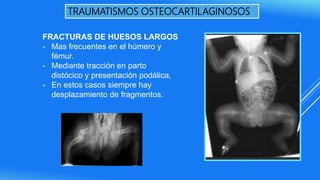 TRAUMATISMOS OSTEOCARTILAGINOSOS
FRACTURAS DE HUESOS LARGOS
- Mas frecuentes en el húmero y
fémur.
- Mediante tracción en parto
distócico y presentación podálica,
- En estos casos siempre hay
desplazamiento de fragmentos.
 